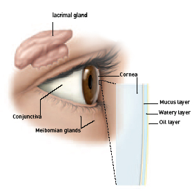 Dry Eye Treatment