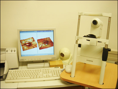 Heidelberg Retinal Tomography